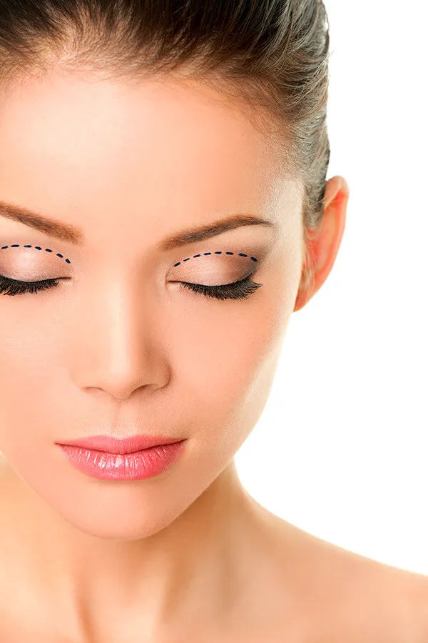 Blepharoplasty - Eyelid Surgery