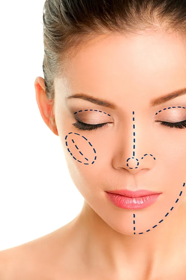 Rhinoplasty - Nose Surgery